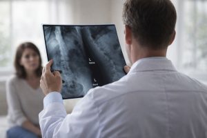レントゲン画像を確認する医師