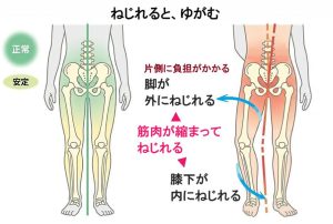 ねじれると、ゆがむイメージ