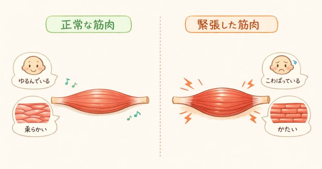 筋肉が縮まり硬くなる図