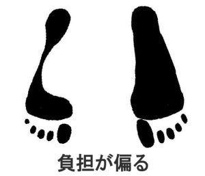 重心が片側にズレ、片脚に負担が掛かっているイメージ