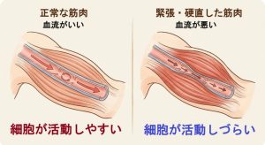 正常な筋肉と硬くなった筋肉の循環が違い、細胞への影響が変わるイラスト