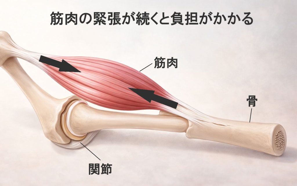 筋肉の緊張が続いて負担がかかるイメージ