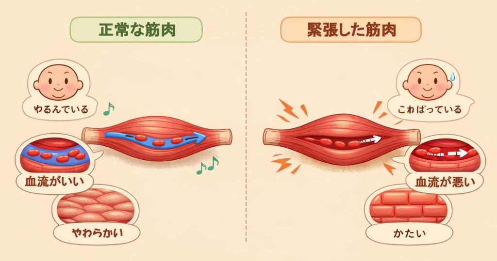 筋肉の正常な状態と緊張状態での血管圧迫