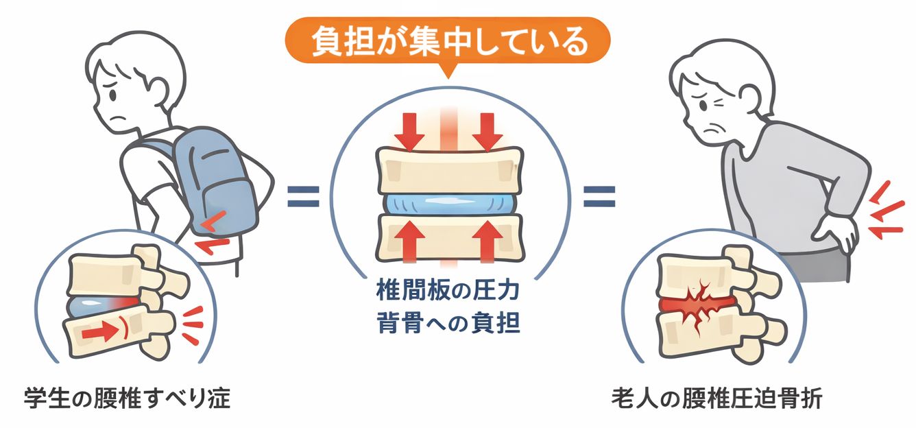 骨に負担が集中しているイメージ