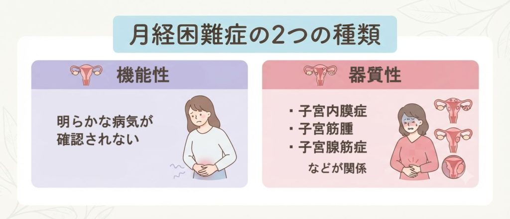 機能性月経困難症と器質性月経困難症の違いを示した図