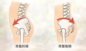骨盤の前傾と後傾