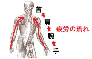 手指から負担が溜まり、肩の筋肉が硬くなる流れを表す絵