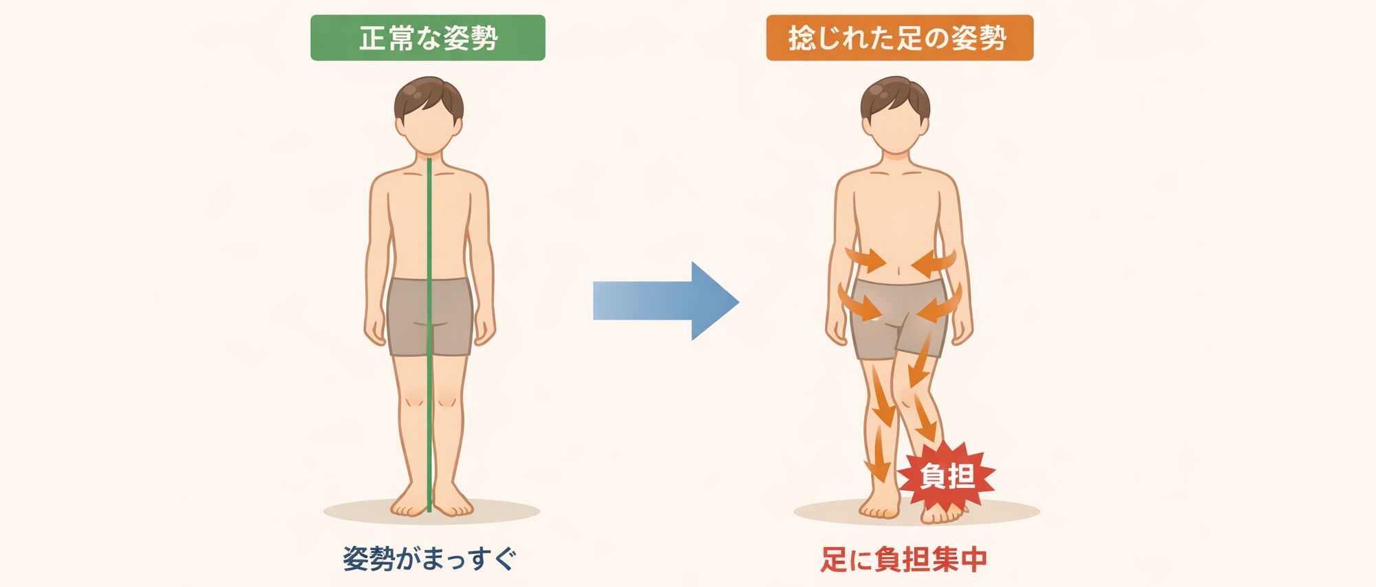 重心のズレの前段階の足の捻じれ