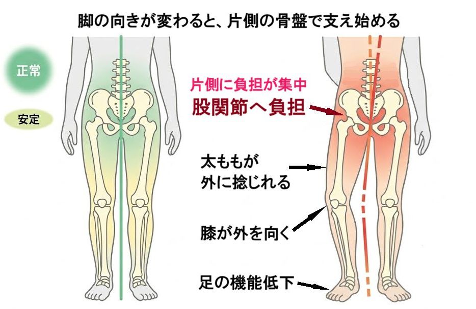 脚の向きが変わると、片側の骨盤で支え始める