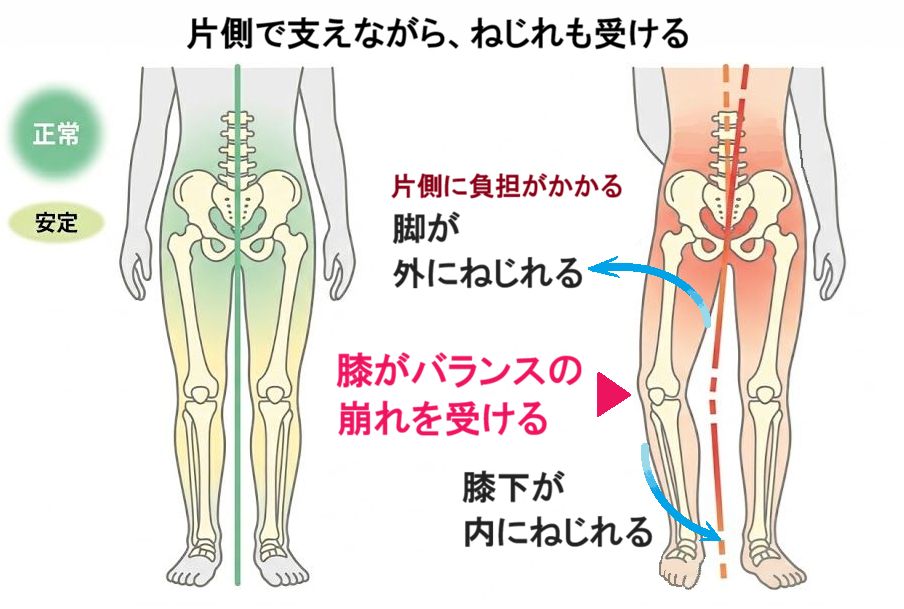 片側で支えながら、ねじれも受けるイメージ