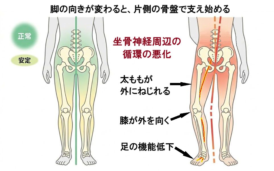 脚の向きが変わると、片側の骨盤で支え始める