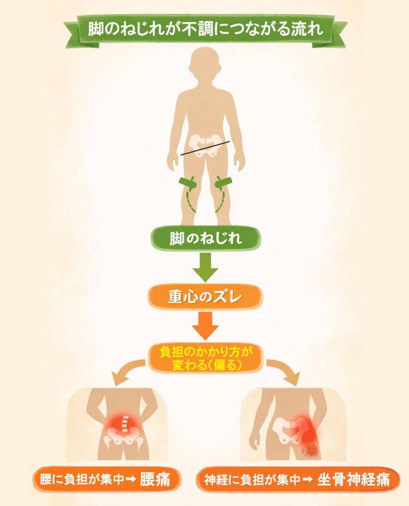 「脚のねじれ」→「重心のズレ」→「負担のかかり方が変わる（偏る）」から「腰痛」や「坐骨神経痛」が発生する図