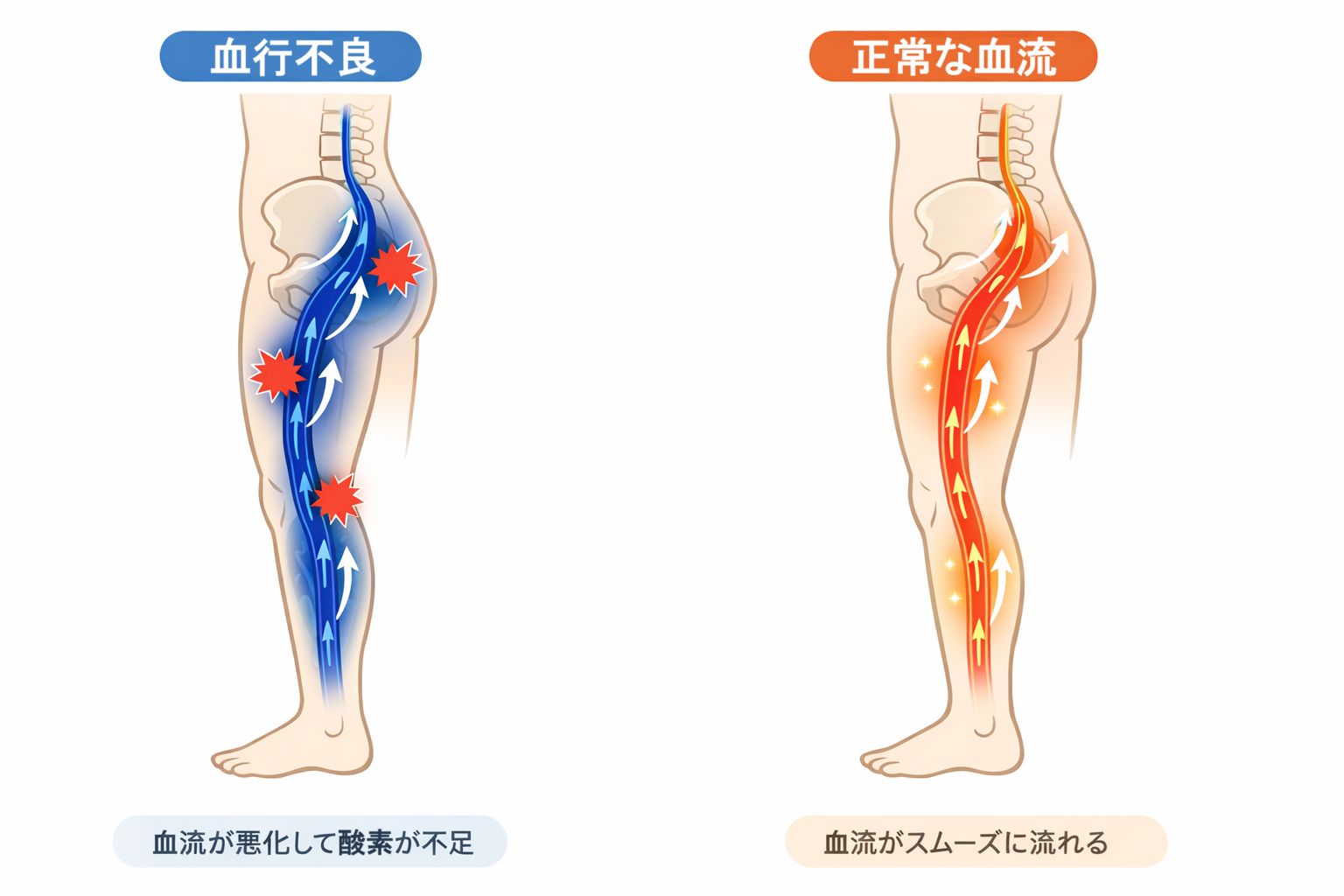 腰・お尻・脚の血行の違いのイメージ