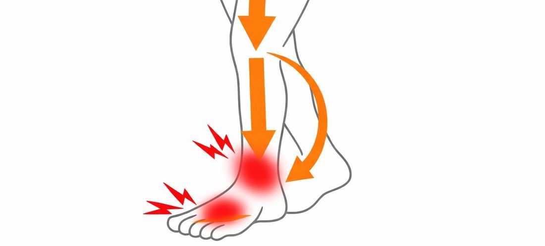 足に負担が掛かっている状態