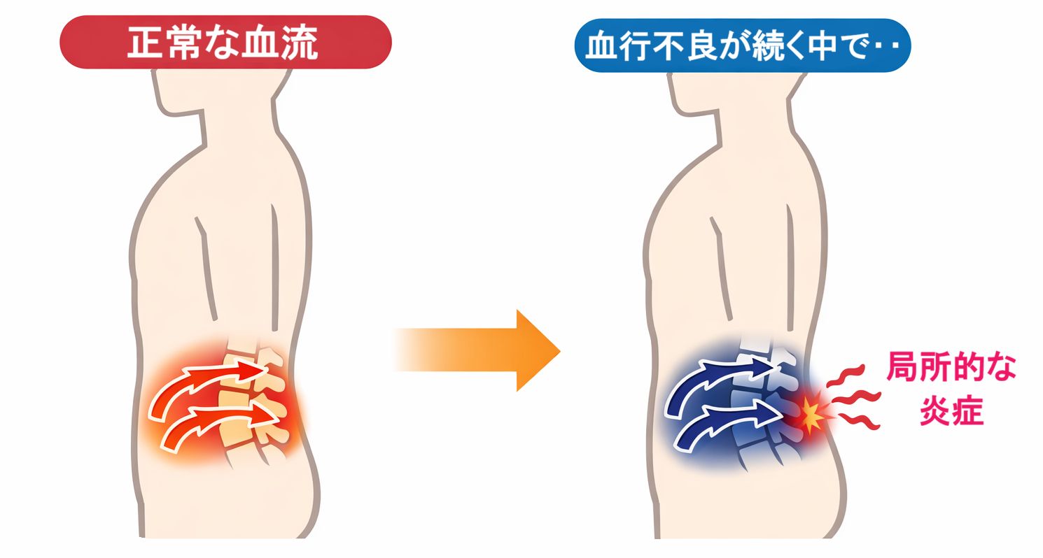 腰の血行の違いのイメージ