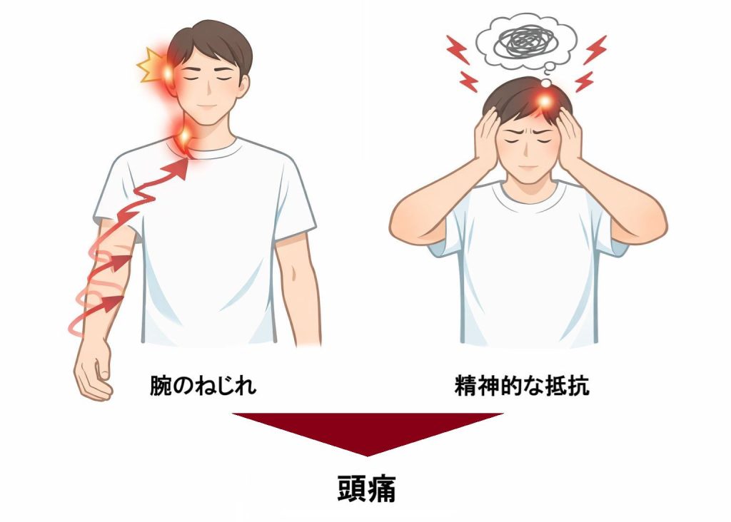 「腕のねじれ」と「精神的な抵抗」から負担が掛かり「頭痛」が発生する図