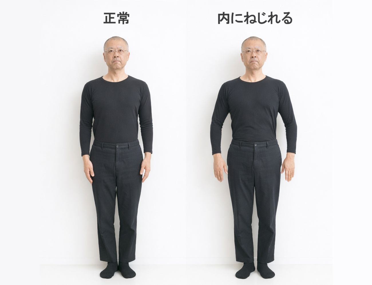 腕のねじれの正常と内にねじれる状態の比較