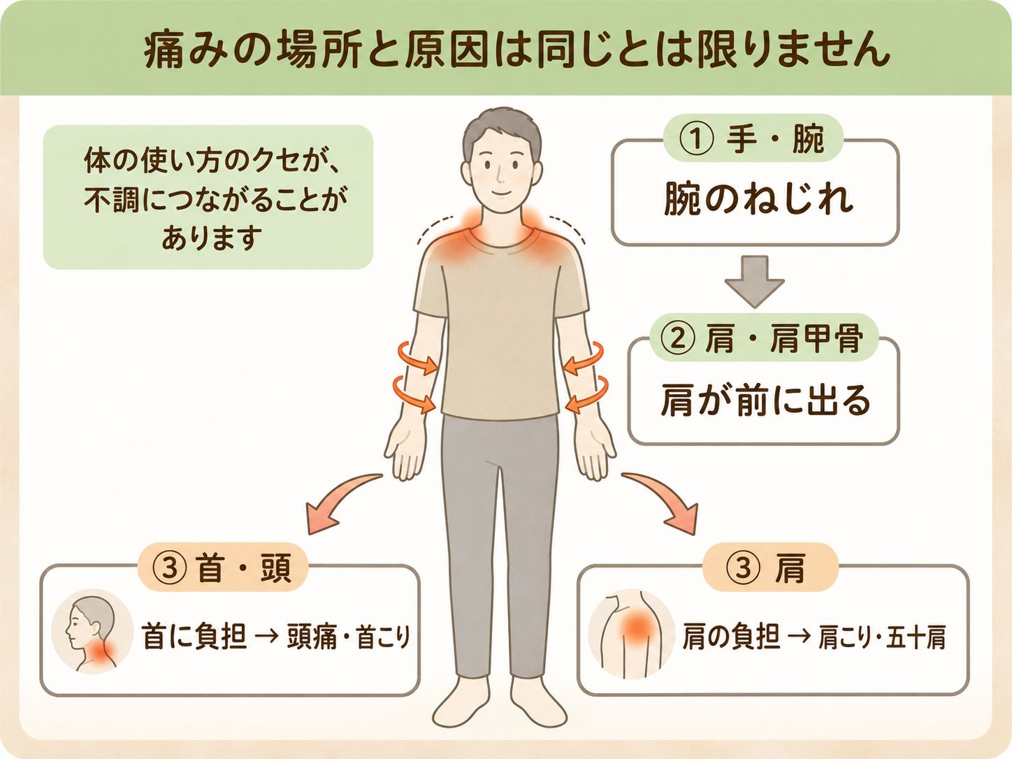腕のねじれから肩・首・頭に負担が広がる図